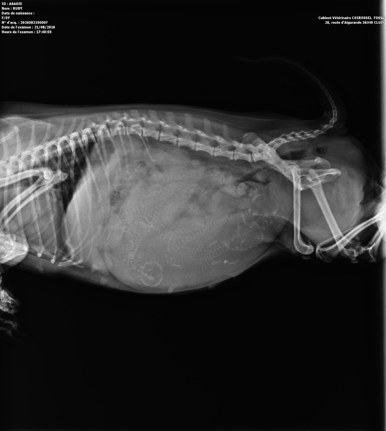 Radiographie de comptage ...